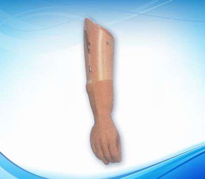 腕离断索控式假肢